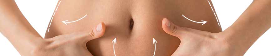 Cirugía plástica Madrid abdominoplastia