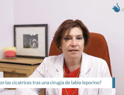 ¿Se nota la cicatriz de labio leporino?