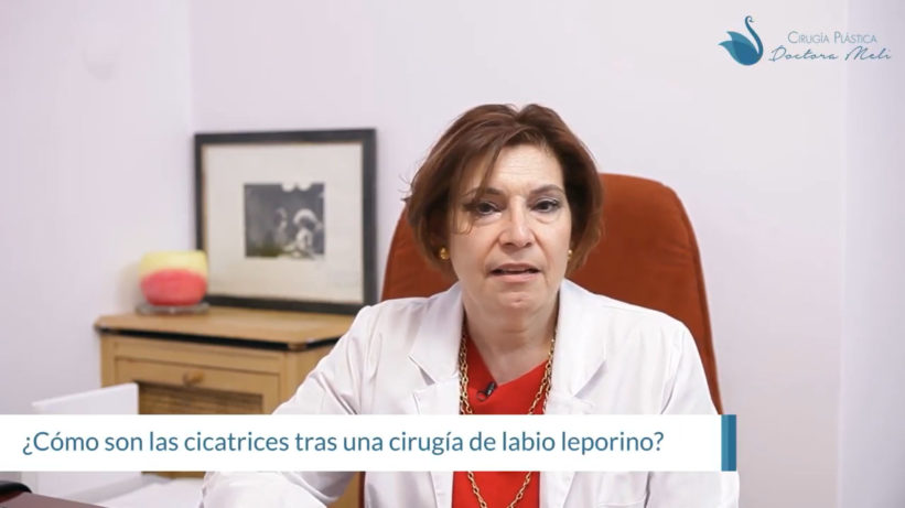 cicatriz de labio leporino