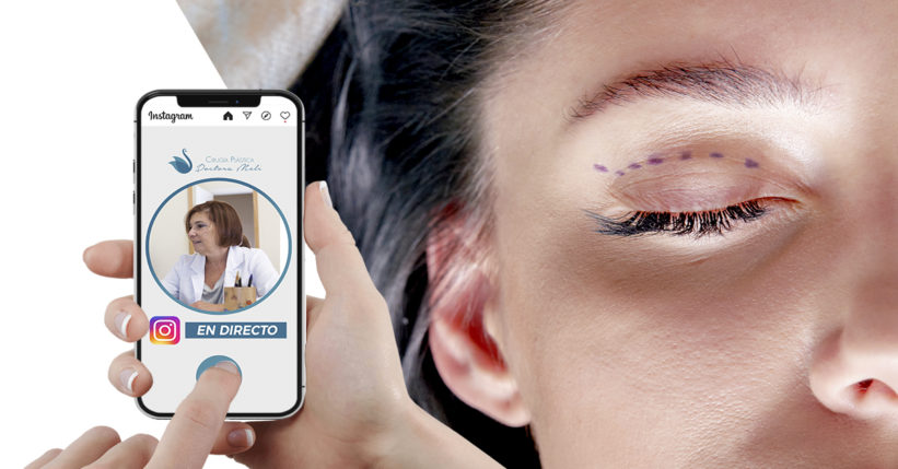 preguntas frecuentes sobre la blefaroplastia