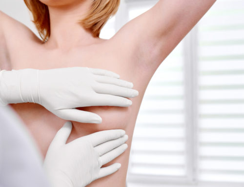¿Qué beneficios permite una reducción de mamas o de pecho?