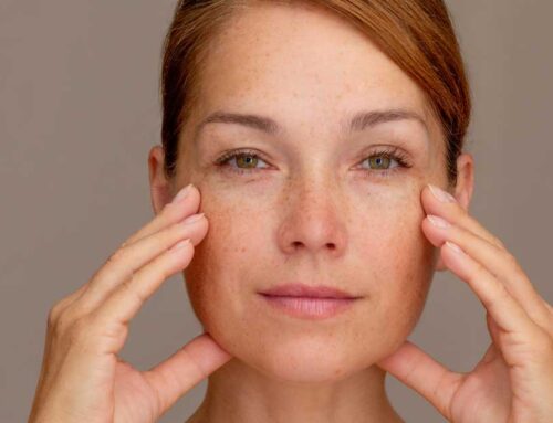 ¿Se puede retocar una blefaroplastia?
