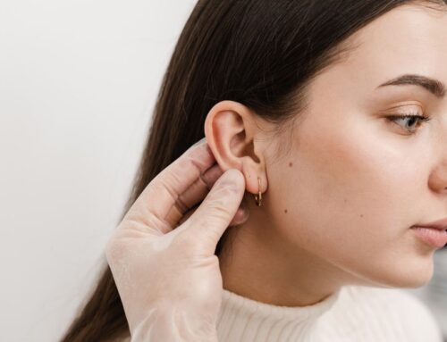 Armonización de orejas: ¿en qué consiste  y qué diferencia hay con la otoplastia?